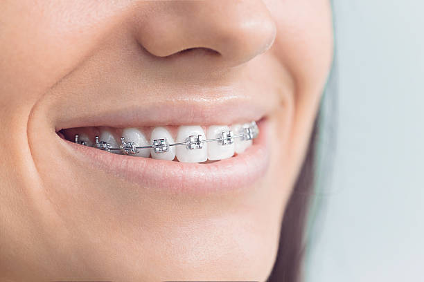 Best Veneers and Lumineers  in Hammond, LA